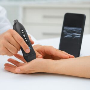 Youkey Q7 Pocket Ultrasound – Ασύρματος Φορητός Υπέρηχος